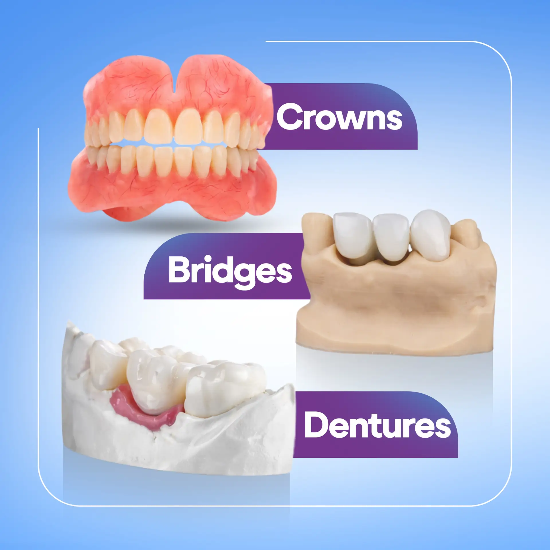 Dentures in Dubai