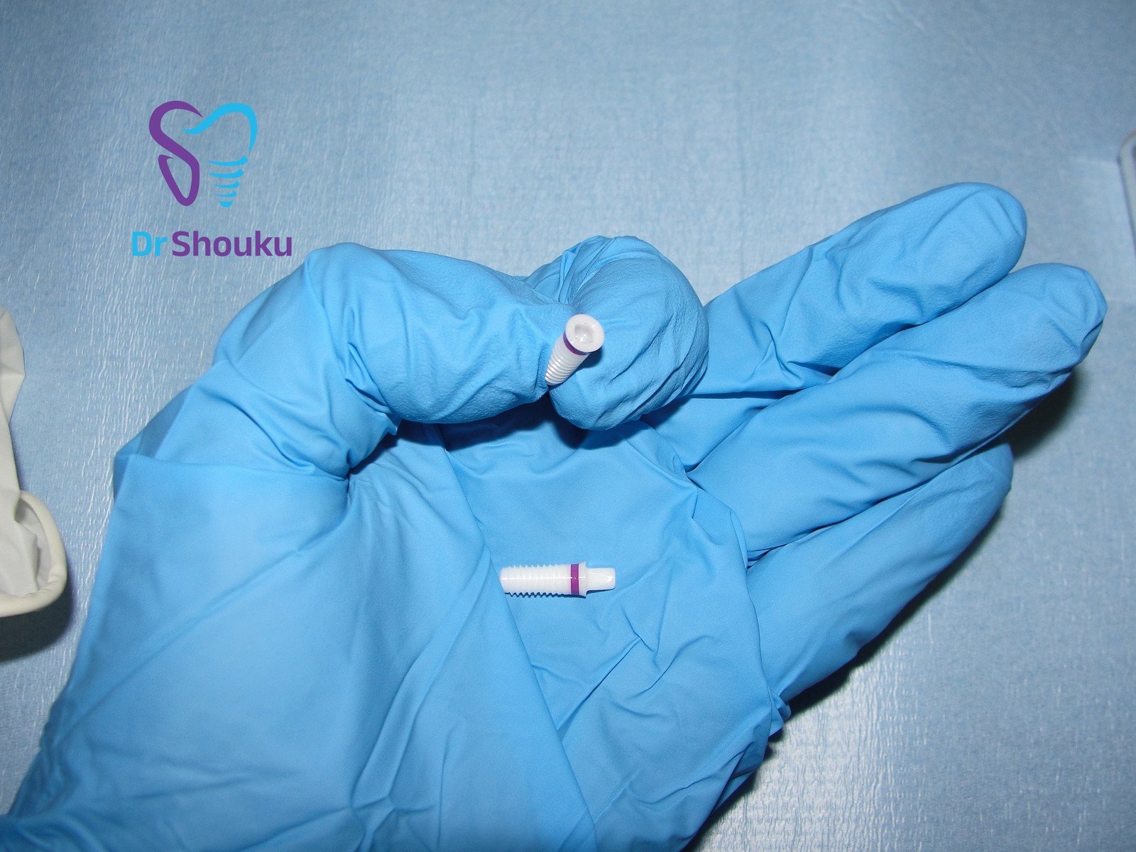 Dental implant components at Dr. Shouku Dental Clinic