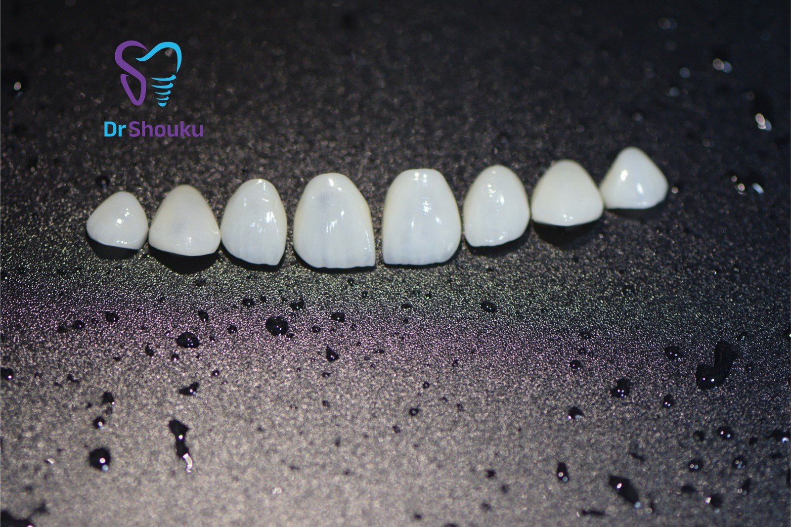Dental veneers arranged on a dark background at Dr. Shouku Dental Clinic