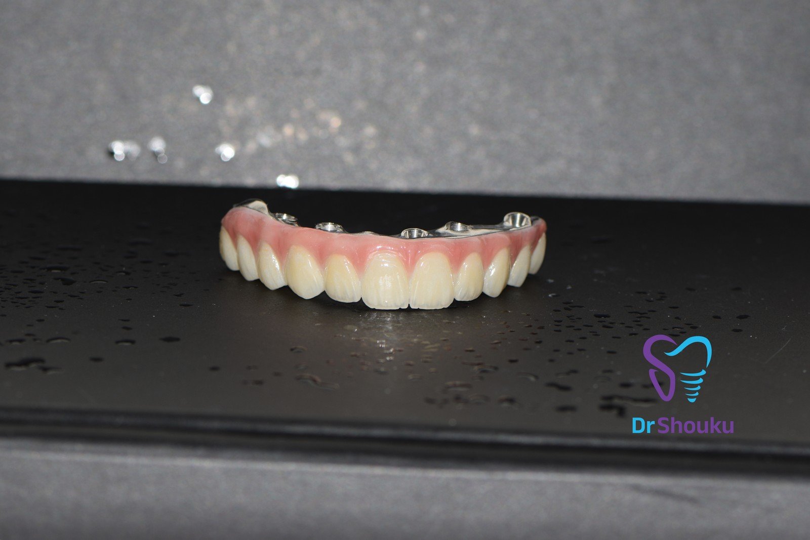 Full-mouth zirconia restoration with a titanium bar at Dr. Shouku Dental Clinic